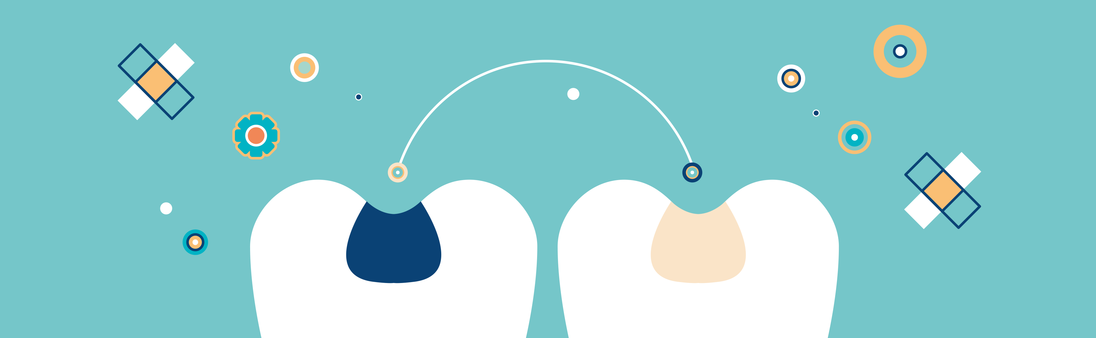 Dentalamalgam